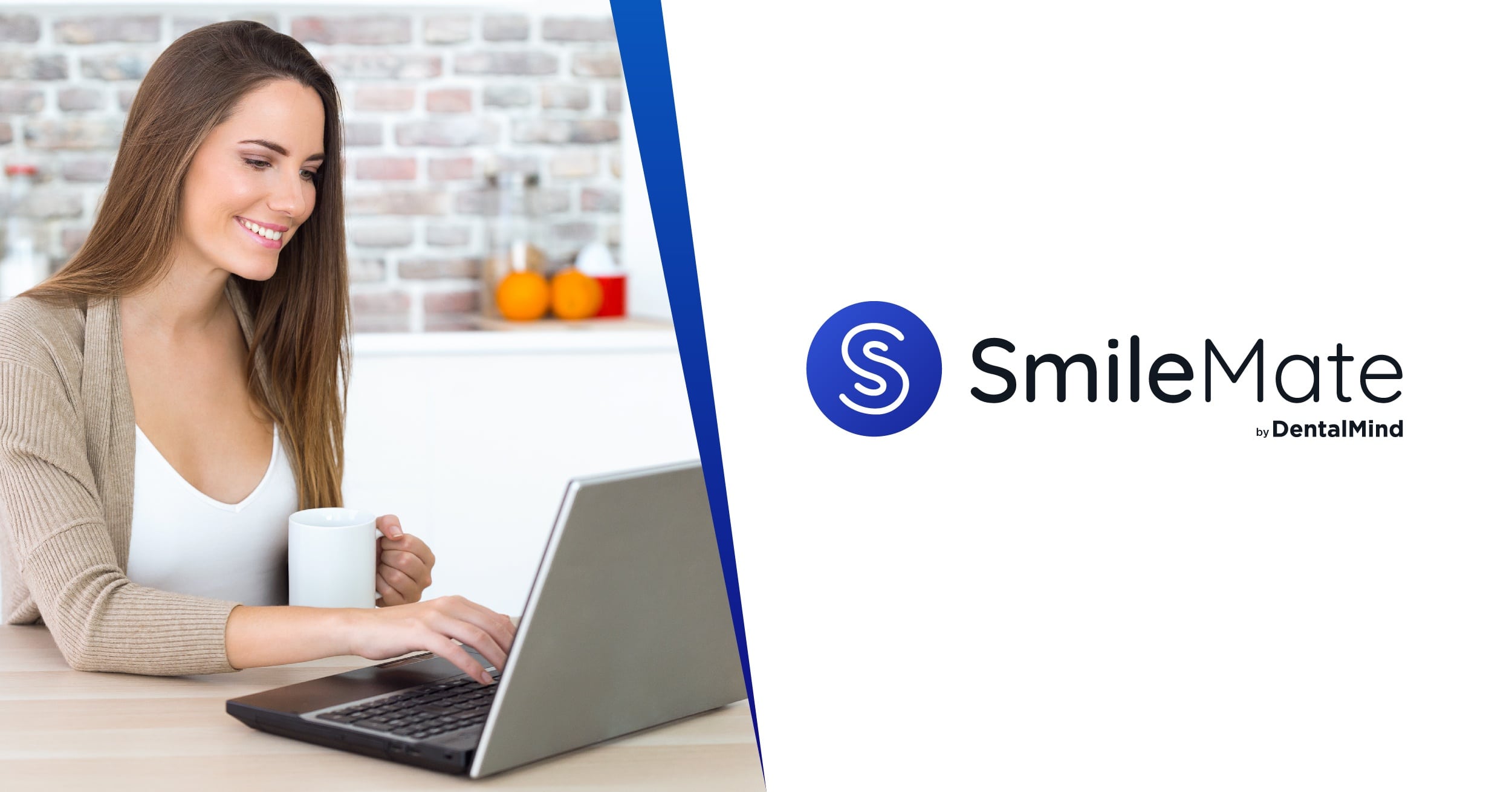 Vorteile unsichtbare Zahnschiene bei Smyle24 - SmileMate